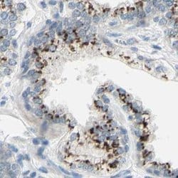 beta-1,4-Galactosyltransferase 1/B4GalT1 Antibody, Novus Biologicals:Antibodies:Primary